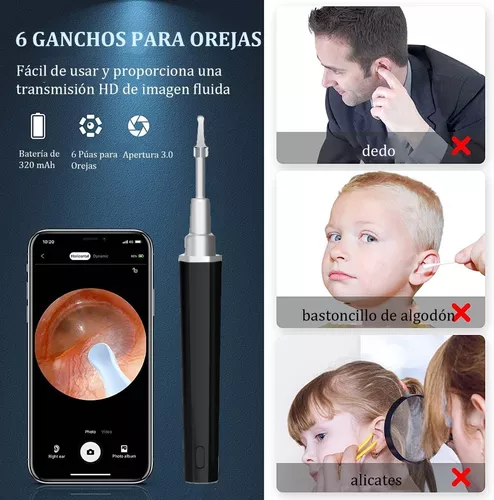 Eliminación de Cera del Oído, Limpiador de Oídos, Cámara con 1080P,  Inalámbrico con Luz, Kit de Limpieza de Oídos para iPhone ISO y Android :  : Salud y Cuidado Personal