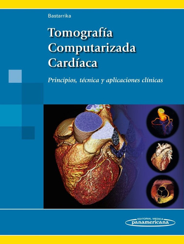 Tomografia Computarizada Cardiaca - Bastarrika Alemañ, Gorka