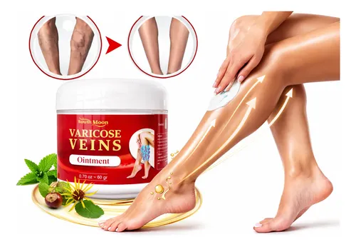 Crema Varicose Veins Pack X2 (cuidado Para Piernas)