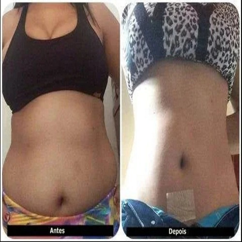 Imagem 5 de 6 de Adesivo Detox Slim Patch Perda De Gordura Localizada