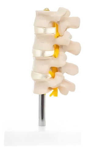 Set Lumbar En 4 Piezas