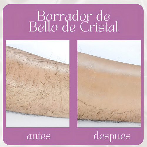 Depiladora de cristal para depilação física Magic Hair Eraser Matte Black Color