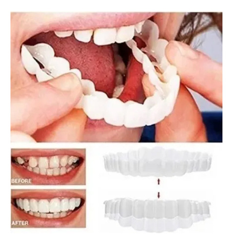 Silicona Superior/inferior Sorriso Dentes Falsos Folheados W