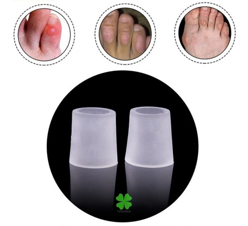 Imagem 4 de 6 de Anel Protetor Silicone 22un Dedos Dos Pés Anti Sensibilidade
