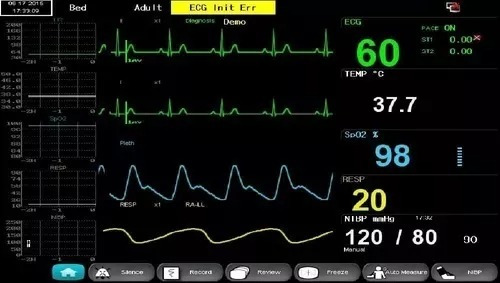 Monitor 6 Parâmetros Etco2 Icu 8 Spo2 Nibp Temp Digital