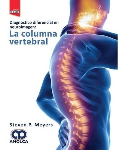 La Columna Vertebral Diagnóstico Diferencial En Neuroimagen