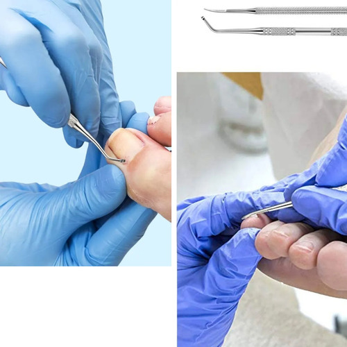 Kit Corrección Uñas Encarnadas Pie Herramienta Pedicura Lima