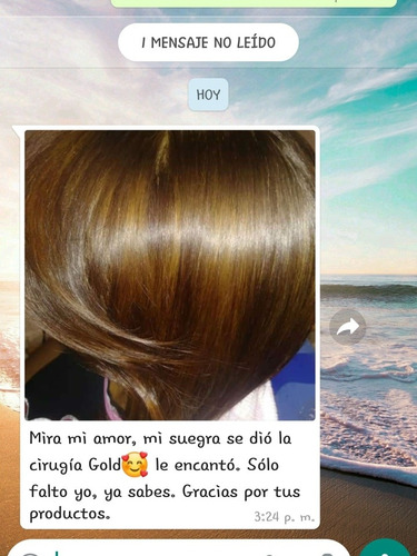 Imagen 5 de 5 de Cirugía Capilar El Mejor Tratamiento