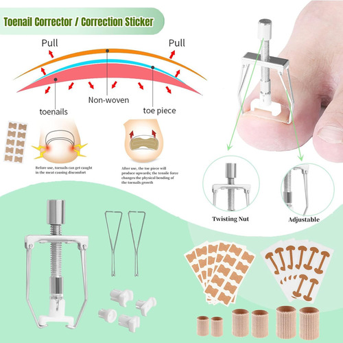 Kit De Tratamiento De Uñas Encarnadas, Herramienta Profesion