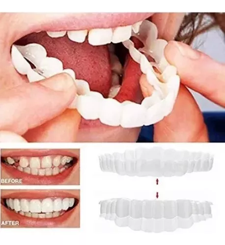 Dientes postizos de chapa de silicona, carillas superiores e inferiores,  dientes falsos temporales, dientes cosméticos, cubierta de dientes falsos,  1 Juego