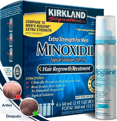 Imagen 1 de 7 de Minoxidil 5% Tópico 6 Meses + Rogaine Dama 5% Espuma 2 Month