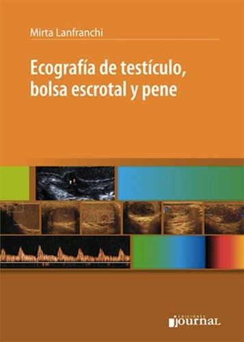 Ecografía De Testículo, Bolsa Escrotal Y Pene - Lanfranchi