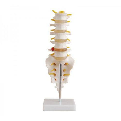 Modelo De Lumbar Didáctico, Con Vertebras Y Hernia De Disco