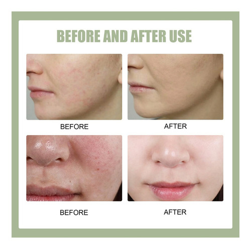 Crema De Recuperación Correct Post Blemish