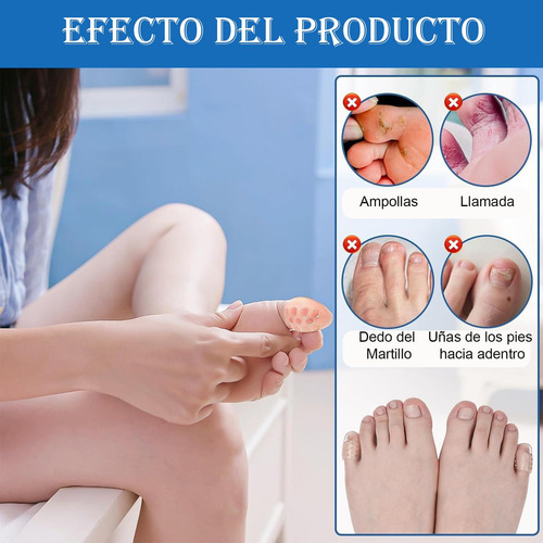10 Piezas Protector Dedos Pie, Protector Para Dedos De Los