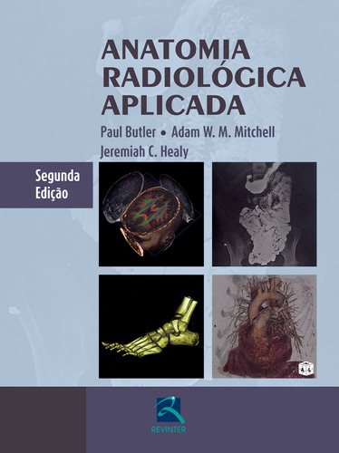 Anatomia Radiológica Aplicada, de Butler, Paul. Editora Thieme Revinter Publicações Ltda, capa dura em português, 2015