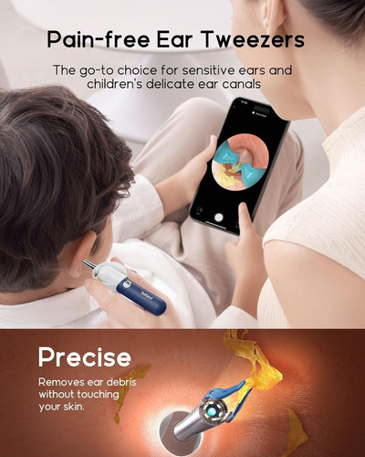 Kit Herramientas P/ Quitar Cera De Los Oídos Bebird Earsight