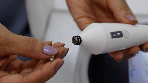 Aparelho Jato De Plasma Com 5 Ponteiras Portátil Bioset