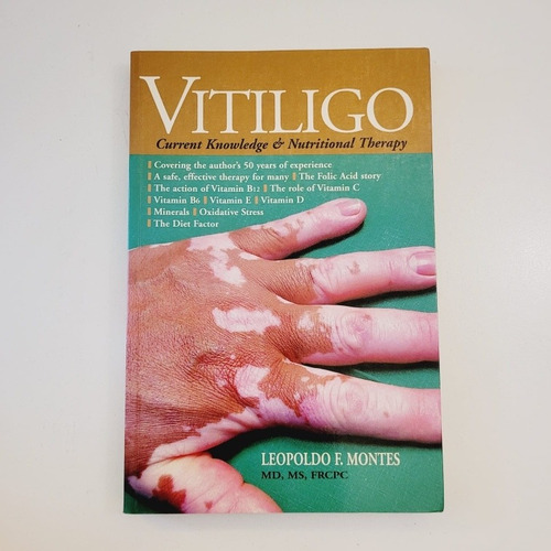  Vitiligo - Leopoldo Montes