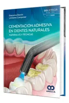 Comprar Cementación Adhesiva En Dientes Naturales. Materiales Y Técn