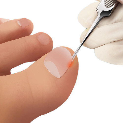 Herramienta Para Pedicura De Uñas De Los Pies 12 Delineador