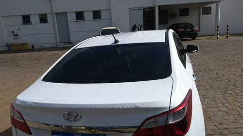 Hyundai Hb20s 2015 1.6 Comfort Plus Flex 4p
