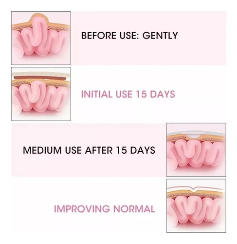 Cinturón De Hernia Umbilical Para Bebés Con Ombligo, 2 Unida