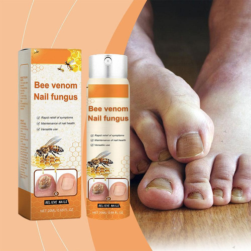 , 2 Sprays Calmantes Para Hongos En Las Uñas De 20 Ml