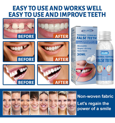 Thermal Forming False Teeth Tooth Repa Kit Tooth Repa