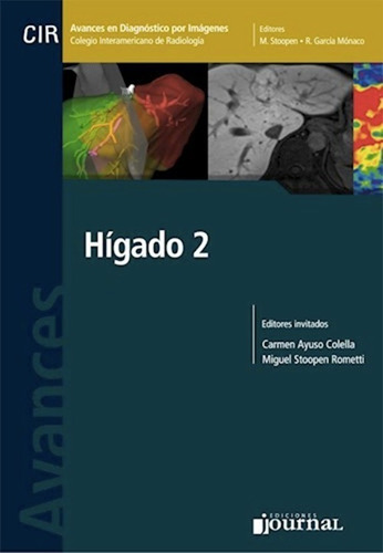 Avances En Diagnostico Por Imágenes Nº 16: Higado 2, De Ayuso Colella / Stoopen. Editorial Journal, Tapa Dura En Español, 2017