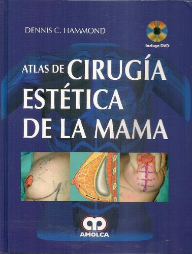 Libro Atlas De Cirugía Estética De La Mama De Dennis C Hammo
