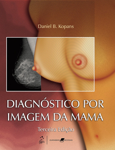 Diagnóstico por Imagem da Mama, de Kopans. Editora Guanabara Koogan Ltda., capa mole em português, 2008
