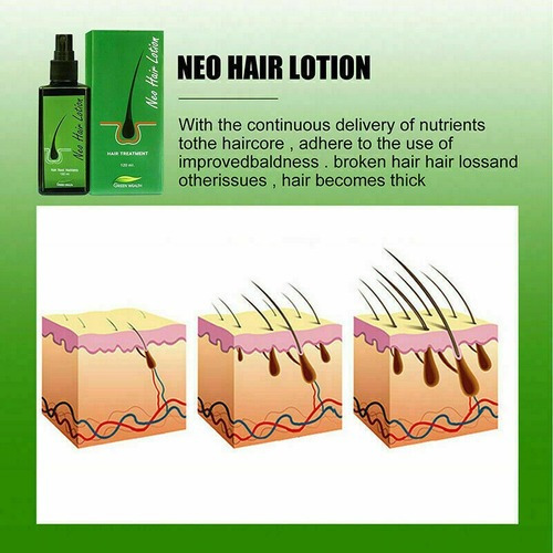 3pcs 30ml Soro Essência Capilar Crescimento Calvície Cabelo