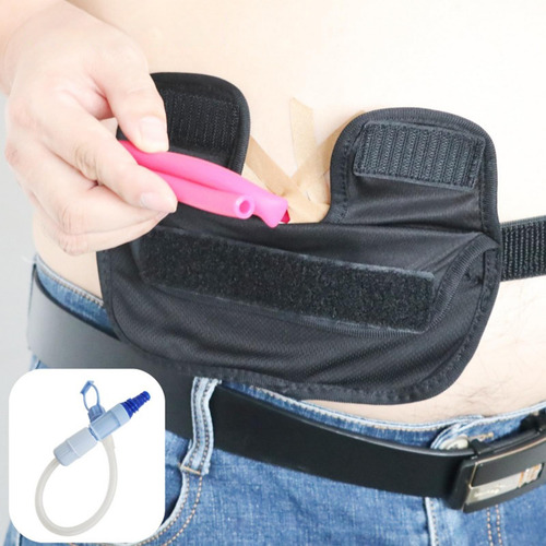 Cinturón De Diálisis Peritoneal, Cinturón De Cintura,