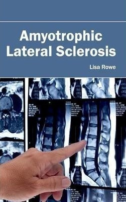 Amyotrophic Lateral Sclerosis - Lisa Rowe (hardback)