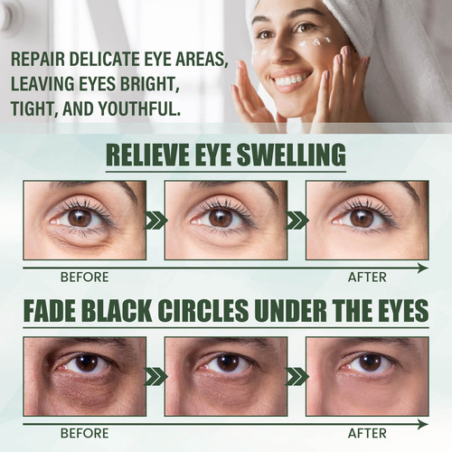Ae Crema De Ojos Anti-envejecimiento