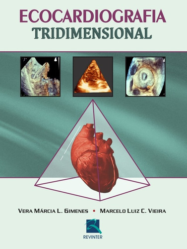 Ecocardiografia Tridimensional, de Gimenes, Vera Márcia L.. Editora Thieme Revinter Publicações Ltda, capa dura em português, 2015