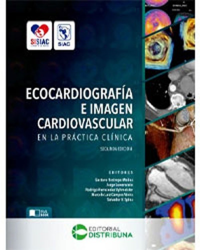 Ecocardiografia E Imagen Cardiovascular En Practica Clinica 