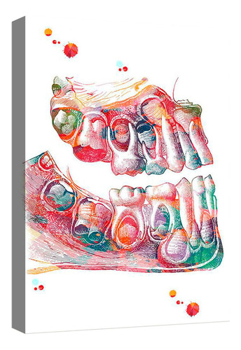 Cuadro Decorativo Canvas Moderno Odontologia Dentadura 2 Armazón Natural
