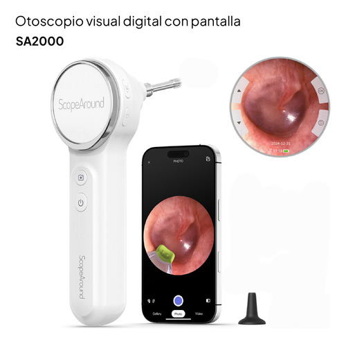 Video Otoscopio Monitor Y Cámara Todo En Uno, Android, Ios