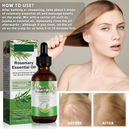 Aceite De Romero Para El Cabello,30ml Rosemary Oil For Hair