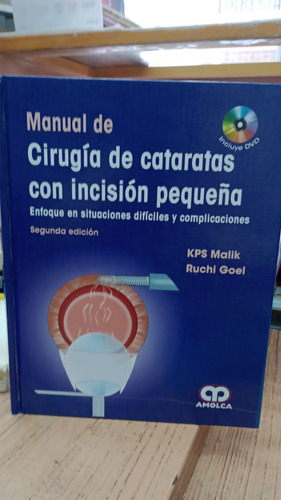 Manual De Cirugia De Cataratas Con Incision 