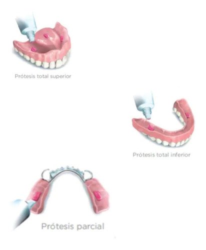 Imagen 2 de 6 de Adhesivo Prótesis Dentales Ultra Corega Crema X 70gr Pack X6