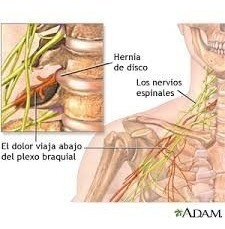 Imagen 3 de 3 de Almohada Huesito Ayuda Cervicales Y Espalda