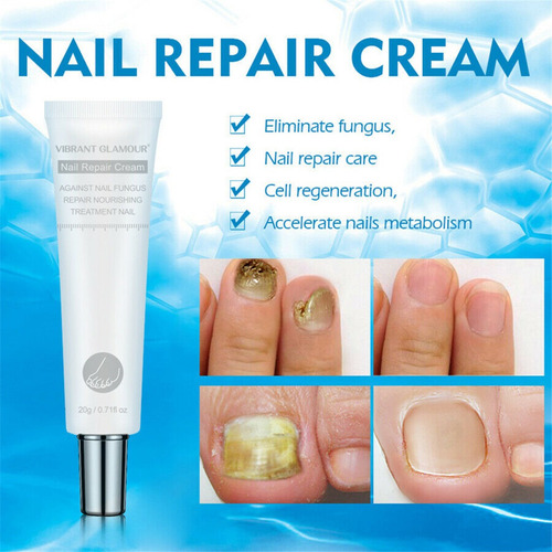 Crema Reparación De Uñas Nail Hongo Tratamiento Onicomicosis