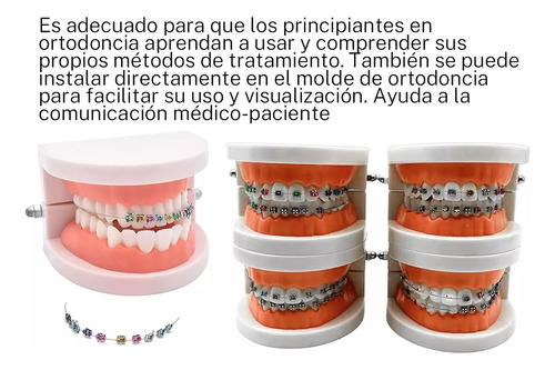Colorido Aparatos Dentales Falsosdecoración Dental Temporal