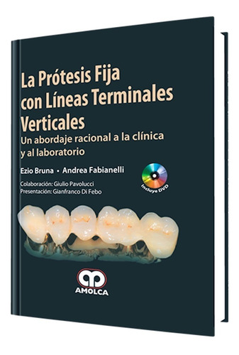 La Prótesis Fija Con Líneas Terminales Verticales. Clín. Lab
