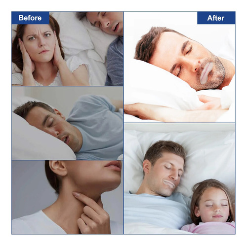 Cinta Adhesiva Mouth Strip Sleep Pcs, 90 Bocas, Para Evitar