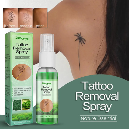 El Aerosol De Eliminación De Tatuajes De 2 Litros Puede Ser