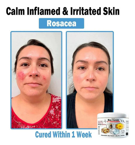 - For Todahof Crema Multisintomática De Integral De Abeja